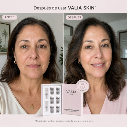 VALIA™ Tratamiento Microagujas Anti Edad