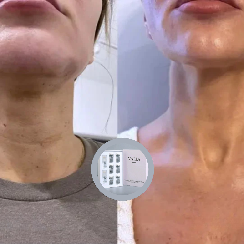 VALIA™ Sistema de Microinfusión Anti Edad