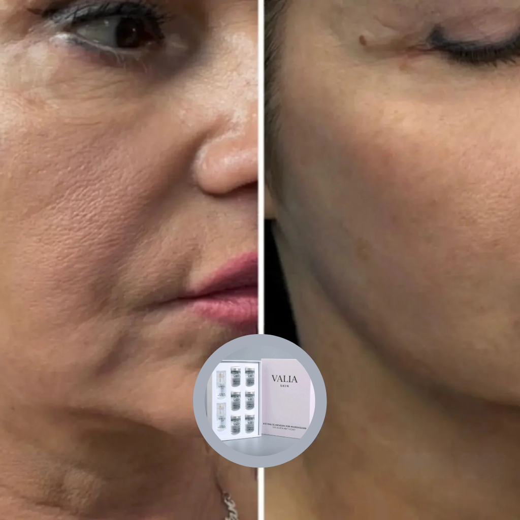 VALIA™ Sistema de Microinfusión Anti Edad