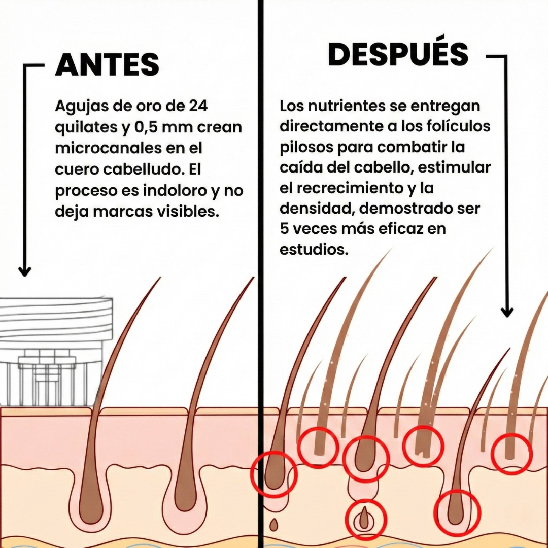 Sistema de regeneración capilar Alphagenix™